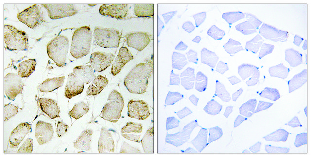 Anti-Arachidonate 5 Lipoxygenase antibody produced in rabbit affinity isolated antibody