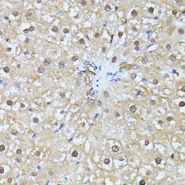 Anti-UBC antibody produced in rabbit