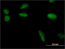 Monoclonal Anti-SUMO1 antibody produced in mouse clone 3D7, purified immunoglobulin, buffered aqueous solution