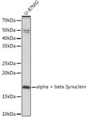 Anti-alpha + beta Synuclein Antibody, clone 9E9X5, Rabbit Monoclonal
