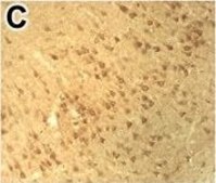 Anti-DNMT3B antibody produced in rabbit Prestige Antibodies&#174; Powered by Atlas Antibodies, affinity isolated antibody, buffered aqueous glycerol solution