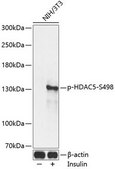 Anti-Phospho-HDAC5-S498 antibody produced in rabbit