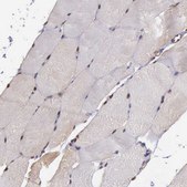 Anti-PSMC1 antibody produced in rabbit Prestige Antibodies&#174; Powered by Atlas Antibodies, affinity isolated antibody, buffered aqueous glycerol solution