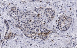 Anti-Cyclin D1 Antibody, clone 1J9, ZooMAb® Rabbit Monoclonal recombinant, expressed in HEK 293 cells