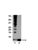 Anti-Ubiquitin Antibody, clone P4D1-A11 clone P4D1-A11, Upstate&#174;, from mouse