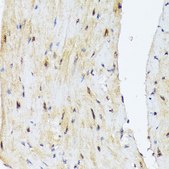 Anti-PSMD14 antibody produced in rabbit