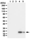 Anti-Histone H3 K4M mutant