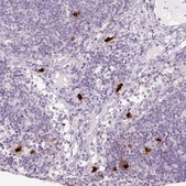 Anti-CMA1 antibody produced in rabbit Prestige Antibodies&#174; Powered by Atlas Antibodies, affinity isolated antibody, buffered aqueous glycerol solution