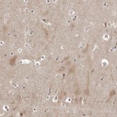 Anti-PTK2B antibody produced in rabbit Prestige Antibodies&#174; Powered by Atlas Antibodies, affinity isolated antibody, buffered aqueous glycerol solution, ab2