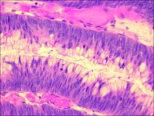 Mayer&#8242;s Hematoxylin Solution