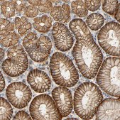 Anti-ARPC1A antibody produced in rabbit Prestige Antibodies&#174; Powered by Atlas Antibodies, affinity isolated antibody, buffered aqueous glycerol solution