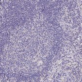 Anti-APOB antibody produced in rabbit Prestige Antibodies&#174; Powered by Atlas Antibodies, affinity isolated antibody, buffered aqueous glycerol solution