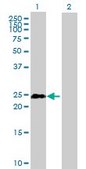 Anti-TCEAL1 antibody produced in mouse IgG fraction of antiserum, buffered aqueous solution