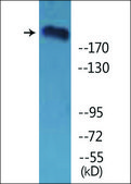 Anti-phospho-ITGB4 (pTyr1510) antibody produced in rabbit affinity isolated antibody