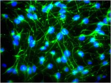 Anti-Nestin Antibody, clone rat-401, Alexa Fluor&#8482; 488 conjugate clone rat-401, from mouse, ALEXA FLUOR&#8482; 488
