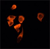 Anti-Sirt2 antibody produced in rabbit affinity isolated antibody, buffered aqueous solution