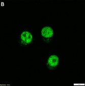 Anti-Bcl-11B Antibody, clone 1G14 ZooMAb&#174; Rabbit Monoclonal recombinant, expressed in HEK 293 cells