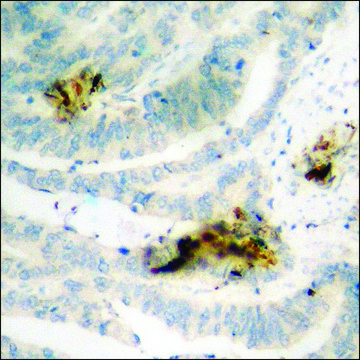 Anti-phospho-NF-kappaB p65 (pThr505) antibody produced in rabbit affinity isolated antibody