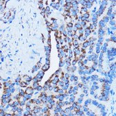Anti-DDIT3/CHOP antibody produced in rabbit