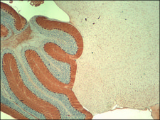 Monoclonal Anti-ITPR1 antibody produced in mouse clone S24-18, 1&#160;mg/mL, purified immunoglobulin