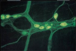 Anti-Neurofilament M (145 kDa) Antibody, CT serum, Chemicon&#174;