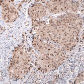 Monoclonal Anti-Msh3 Antibody Produced In Mouse Prestige Antibodies&#174; Powered by Atlas Antibodies, clone CL14064, affinity isolated antibody, buffered aqueous glycerol solution