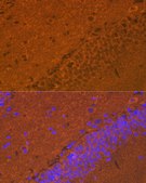 Anti-alpha + beta Synuclein Antibody, clone 9E9X5, Rabbit Monoclonal