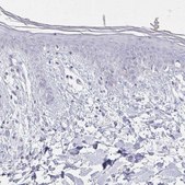 Anti-CASQ2 antibody produced in rabbit Prestige Antibodies&#174; Powered by Atlas Antibodies, affinity isolated antibody, buffered aqueous glycerol solution