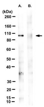 Anti-phospho-VCP (Ser784) Antibody, clone 3E4