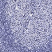 Anti-DNALI1 antibody produced in rabbit Prestige Antibodies&#174; Powered by Atlas Antibodies, affinity isolated antibody, buffered aqueous glycerol solution