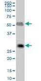 Anti-IGLL1 antibody produced in mouse purified immunoglobulin, buffered aqueous solution