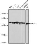 Anti-NF-&#954;B2 Antibody, clone 4K3V3, Rabbit Monoclonal