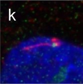 Anti-ODF2 antibody produced in rabbit Prestige Antibodies&#174; Powered by Atlas Antibodies, affinity isolated antibody, buffered aqueous glycerol solution