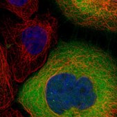 Anti-LDHB antibody produced in rabbit Prestige Antibodies® Powered by Atlas Antibodies, affinity isolated antibody, buffered aqueous glycerol solution