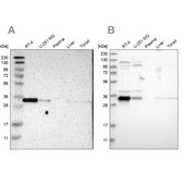 Anti-CASP6 antibody produced in rabbit Prestige Antibodies® Powered by Atlas Antibodies, affinity isolated antibody, buffered aqueous glycerol solution