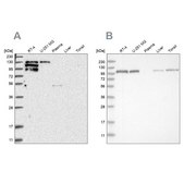 Anti-PTK2B antibody produced in rabbit Prestige Antibodies&#174; Powered by Atlas Antibodies, affinity isolated antibody, buffered aqueous glycerol solution, ab1