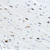 Anti-TEAD1 antibody produced in rabbit