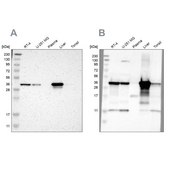 Anti-ACAA1 antibody produced in rabbit Ab1, Prestige Antibodies&#174; Powered by Atlas Antibodies, affinity isolated antibody, buffered aqueous glycerol solution