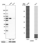 Anti-ACBD5 antibody produced in rabbit Prestige Antibodies&#174; Powered by Atlas Antibodies, affinity isolated antibody, buffered aqueous glycerol solution