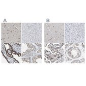 Anti-PCNT antibody produced in rabbit Prestige Antibodies&#174; Powered by Atlas Antibodies, affinity isolated antibody, buffered aqueous glycerol solution, Ab2