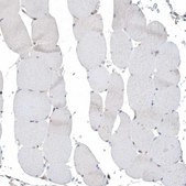 Anti-PSD4 antibody produced in rabbit Prestige Antibodies&#174; Powered by Atlas Antibodies, affinity isolated antibody, buffered aqueous glycerol solution