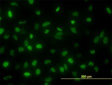 Monoclonal Anti-TOP2A antibody produced in mouse clone 1E2, purified immunoglobulin, buffered aqueous solution
