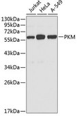 Anti-PKM antibody produced in rabbit