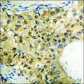 Anti-phospho-FKHR (pSer319) antibody produced in rabbit affinity isolated antibody