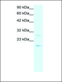 Anti-CLDN1 antibody produced in rabbit affinity isolated antibody