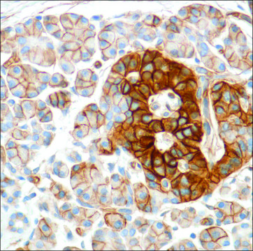 Anti-HENT1 antibody, Rabbit monoclonal recombinant, expressed in proprietary host, clone SP120, affinity isolated antibody