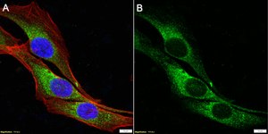 Anti-Collagen VI &#945;3 Antibody, clone 3C4 ZooMAb&#174; Mouse Monoclonal recombinant, expressed in HEK 293 cells