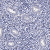 Anti-TYRP1 antibody produced in rabbit Prestige Antibodies&#174; Powered by Atlas Antibodies, affinity isolated antibody, buffered aqueous glycerol solution