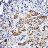 Anti- SND1 antibody produced in rabbit