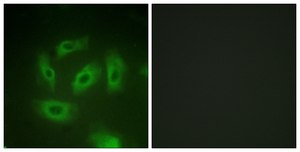 Anti-TGF &#946; Receptor I antibody produced in rabbit affinity isolated antibody